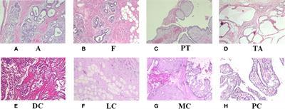 Self-attention random forest for breast cancer image classification